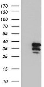 sand sds fisher,Sand SDS Fisher: A Comprehensive Overview